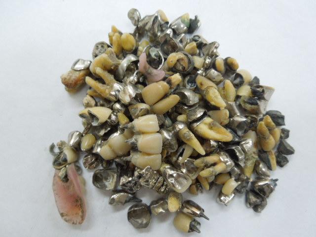 歯科金属屑・歯科スクラップ金属(撤去冠・除去冠)