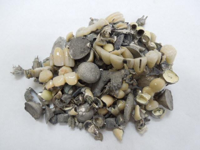 歯科金属屑・歯科スクラップ金属(撤去冠・除去冠)