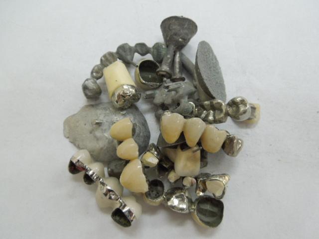 歯科金属屑・歯科スクラップ金属(撤去冠・除去冠)