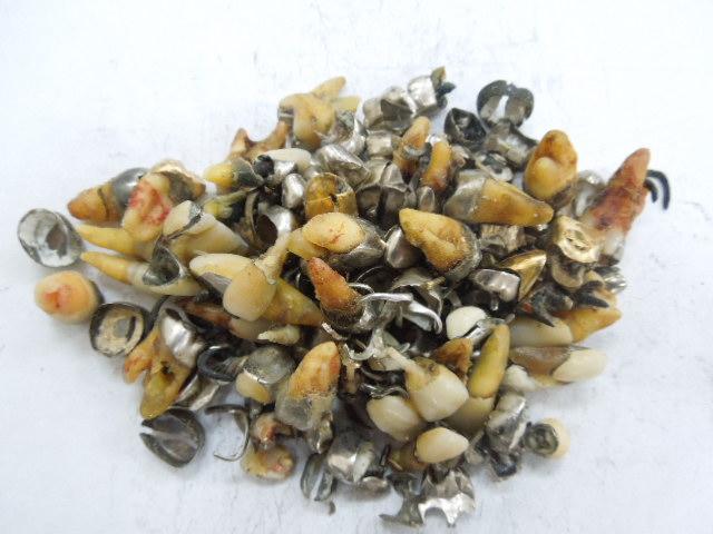 歯科金属屑・歯科スクラップ金属(撤去冠・除去冠)