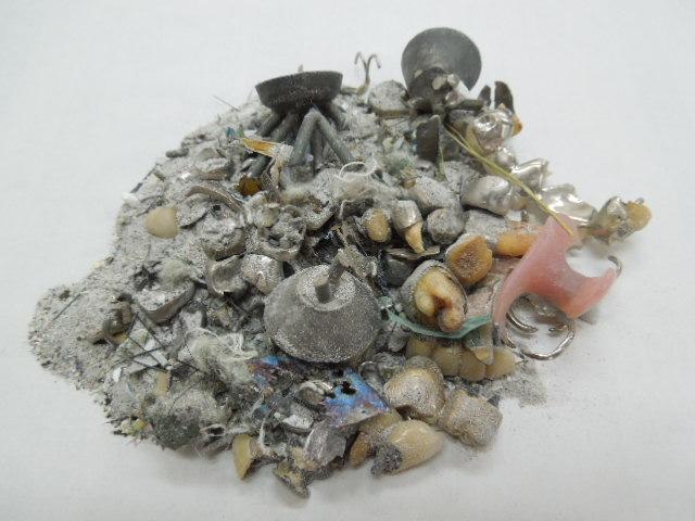 その他の精錬・分析を要する歯科金属・歯科技工金属