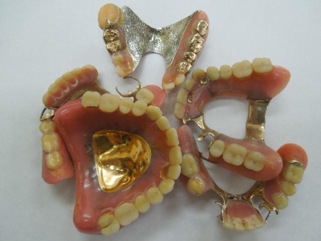 その他の精錬・分析を要する歯科金属・歯科技工金属