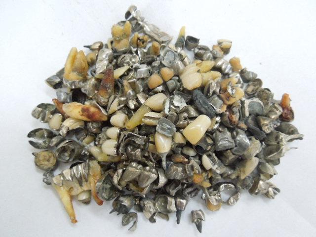 歯科金属屑・歯科スクラップ金属(撤去冠・除去冠)