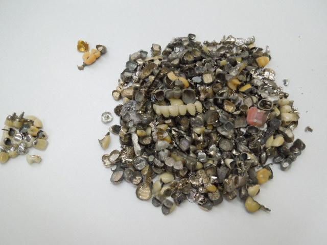 歯科金属屑・歯科スクラップ金属(撤去冠・除去冠)