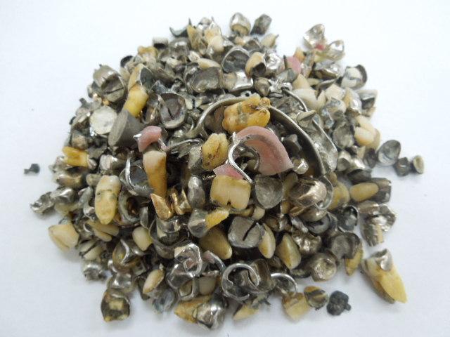 歯科金属屑・歯科スクラップ金属(撤去冠・除去冠)