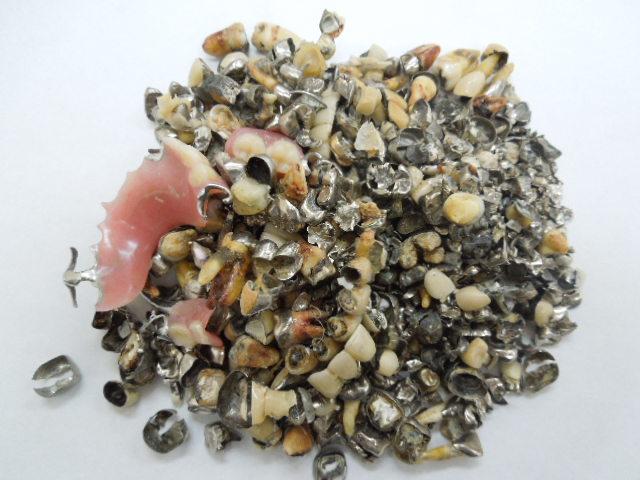 歯科金属屑・歯科スクラップ金属(撤去冠・除去冠)