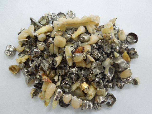 歯科金属屑・歯科スクラップ金属(撤去冠・除去冠)