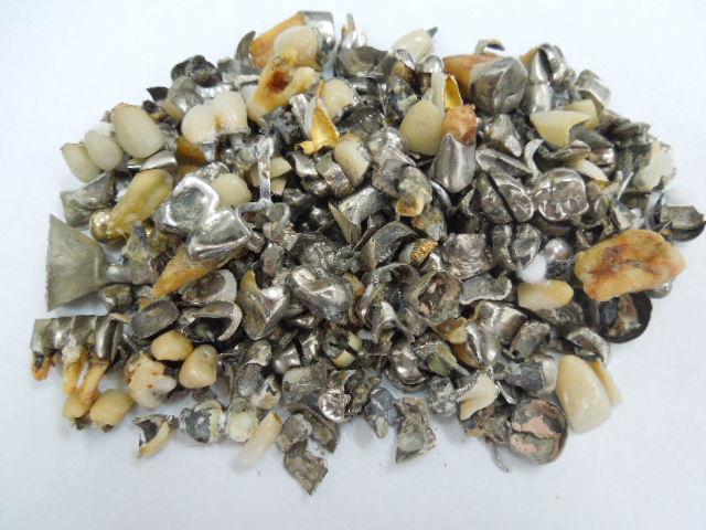 歯科金属屑・歯科スクラップ金属(撤去冠・除去冠)