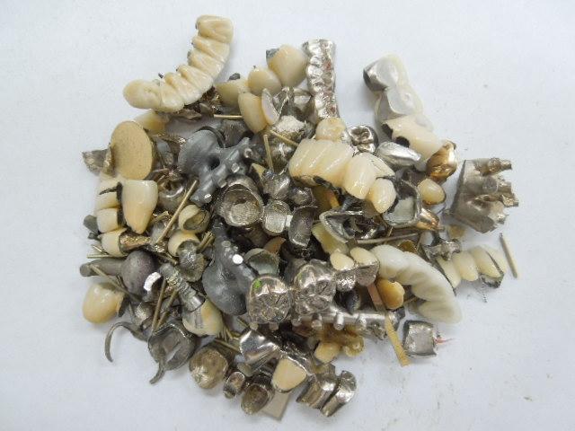 歯科金属屑・歯科スクラップ金属(撤去冠・除去冠)