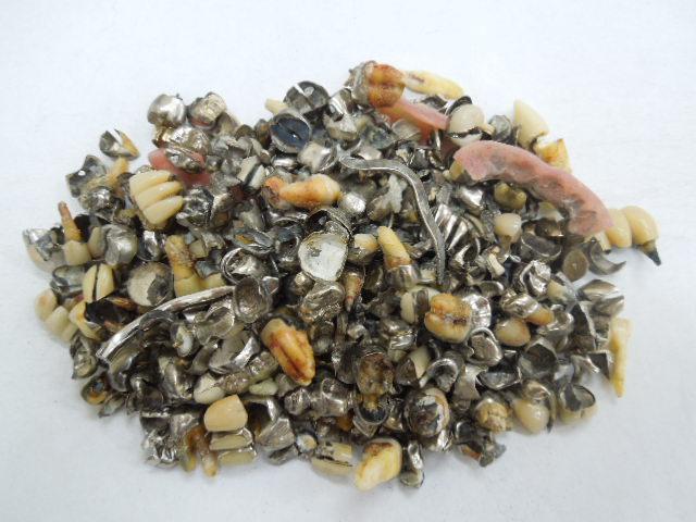 歯科金属屑・歯科スクラップ金属(撤去冠・除去冠)