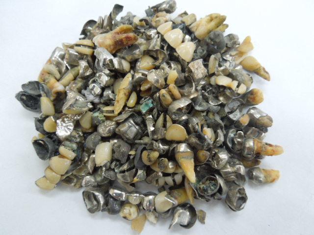 歯科金属屑・歯科スクラップ金属(撤去冠・除去冠)