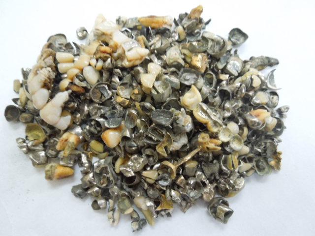 歯科金属屑・歯科スクラップ金属(撤去冠・除去冠)