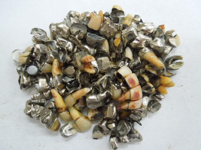 歯科金属屑・歯科スクラップ金属(撤去冠・除去冠)