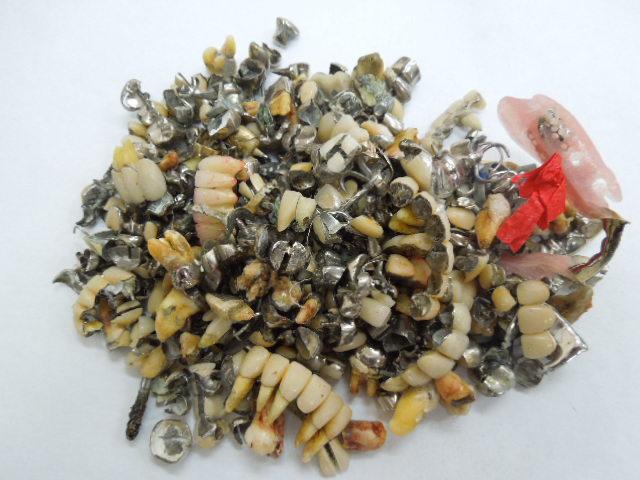 歯科金属屑・歯科スクラップ金属(撤去冠・除去冠)