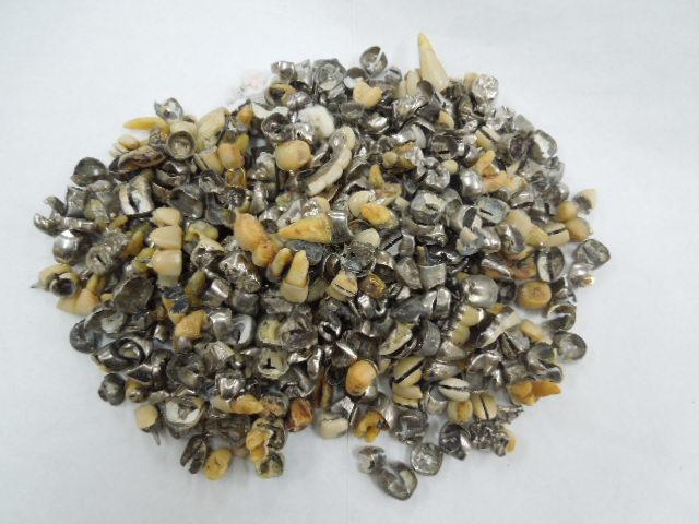 歯科金属屑・歯科スクラップ金属(撤去冠・除去冠)