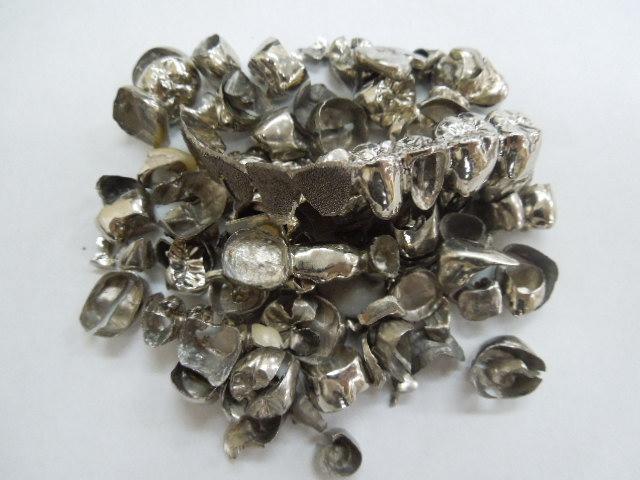 歯科金属屑・歯科スクラップ金属(撤去冠・除去冠)