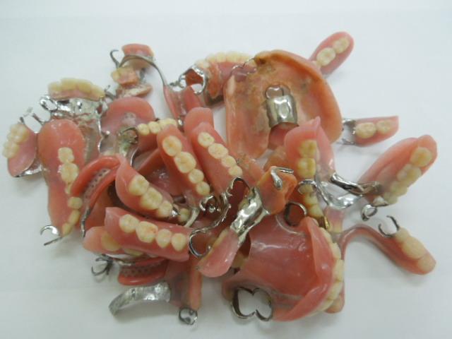 その他の精錬・分析を要する歯科金属・歯科技工金属