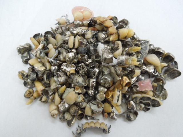 歯科金属屑・歯科スクラップ金属(撤去冠・除去冠)