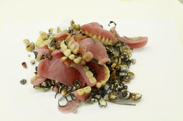 歯科金属屑・歯科スクラップ金属(撤去冠・除去冠)