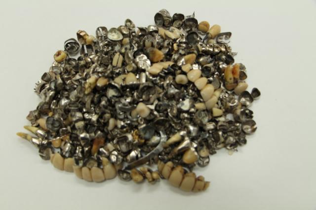 歯科金属屑・歯科スクラップ金属(撤去冠・除去冠)