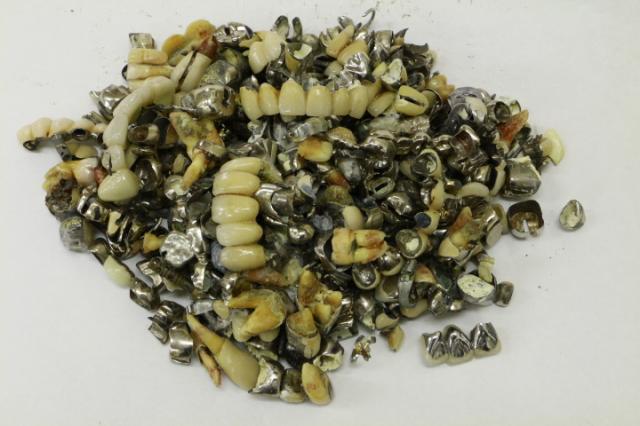 歯科金属屑・歯科スクラップ金属(撤去冠・除去冠)