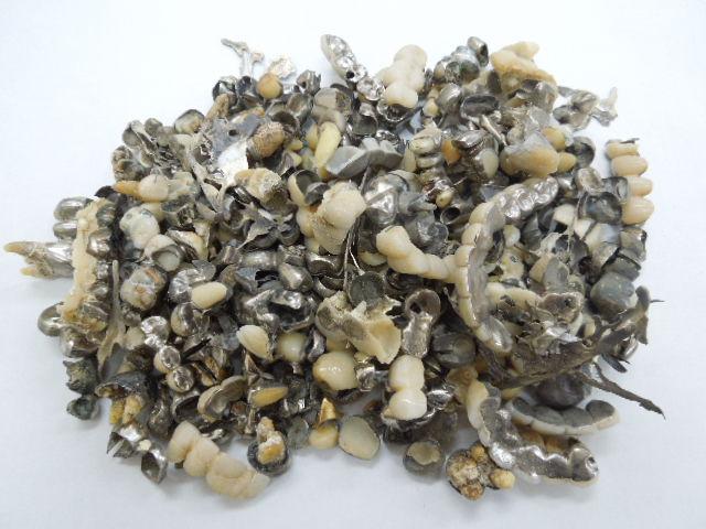 歯科金属屑・歯科スクラップ金属(撤去冠・除去冠)