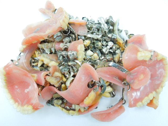 歯科金属屑・歯科スクラップ金属(撤去冠・除去冠)