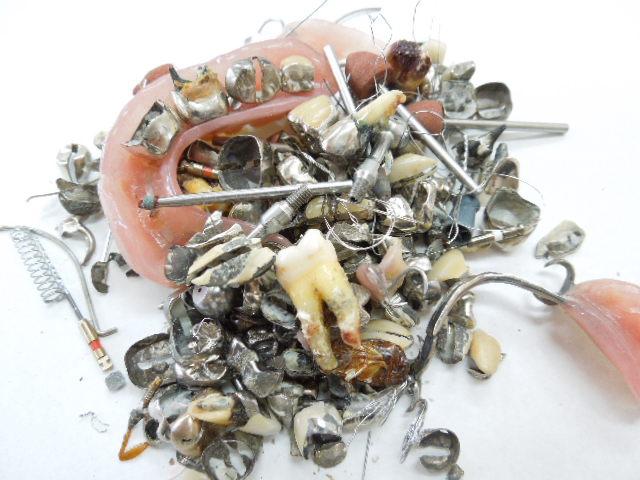 歯科金属屑・歯科スクラップ金属(撤去冠・除去冠)