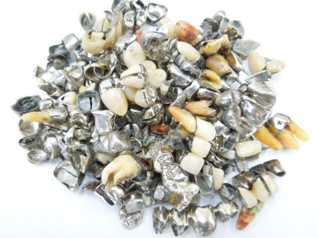 歯科金属屑・歯科スクラップ金属(撤去冠・除去冠)