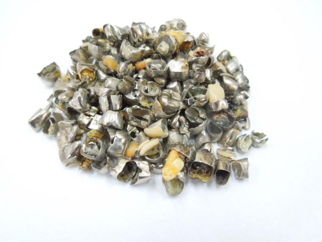 歯科金属屑・歯科スクラップ金属(撤去冠・除去冠)