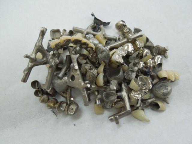 歯科金属屑・歯科スクラップ金属(撤去冠・除去冠)