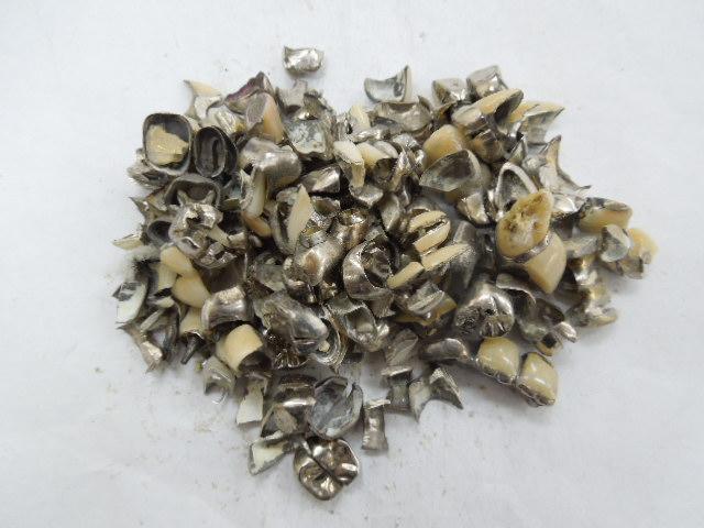 歯科金属屑・歯科スクラップ金属(撤去冠・除去冠)