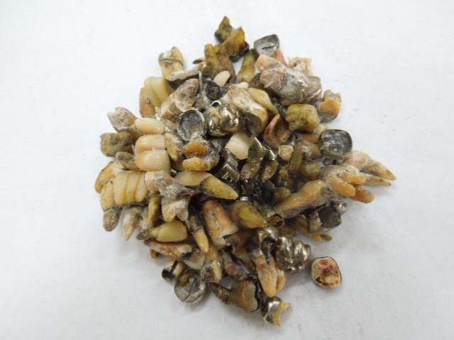 歯科金属屑・歯科スクラップ金属(撤去冠・除去冠)