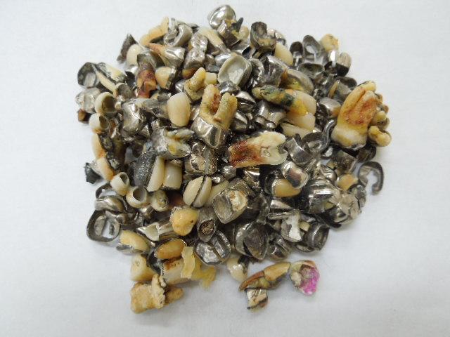 歯科金属屑・歯科スクラップ金属(撤去冠・除去冠)