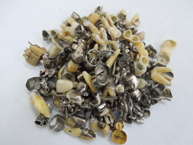 歯科金属屑・歯科スクラップ金属(撤去冠・除去冠)