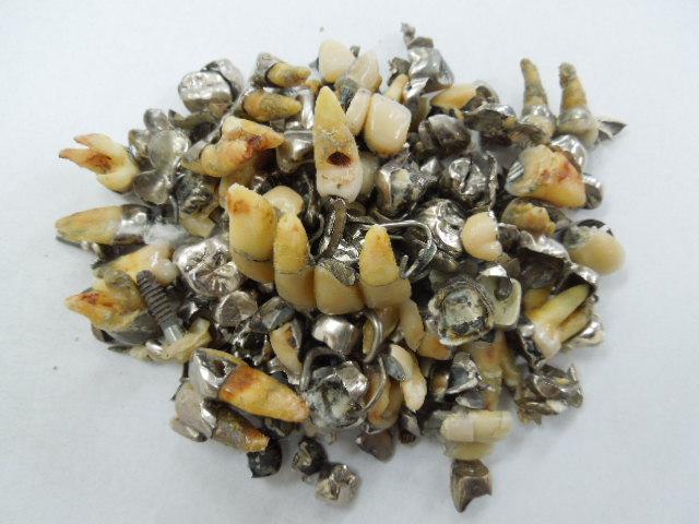 歯科金属屑・歯科スクラップ金属(撤去冠・除去冠)