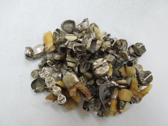 歯科金属屑・歯科スクラップ金属(撤去冠・除去冠)