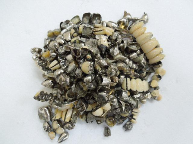 歯科金属屑・歯科スクラップ金属(撤去冠・除去冠)