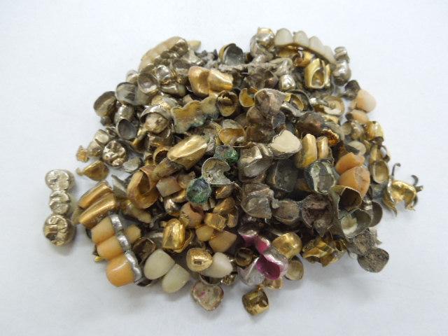 歯科金属屑・歯科スクラップ金属(撤去冠・除去冠)