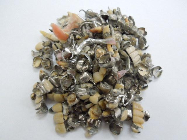 歯科金属屑・歯科スクラップ金属(撤去冠・除去冠)