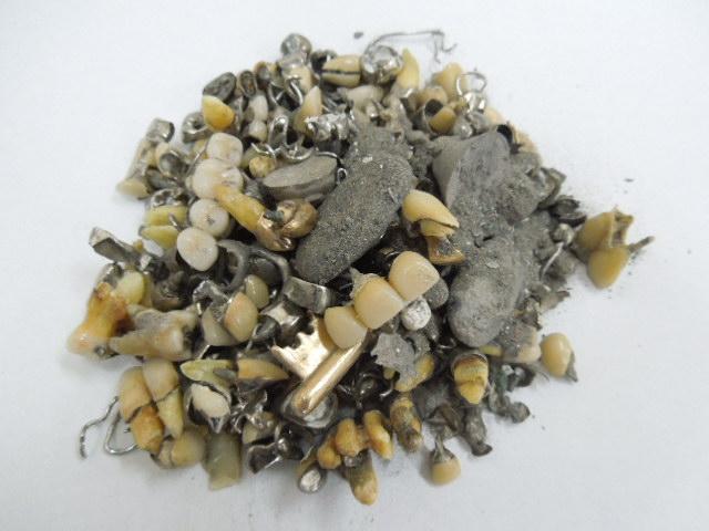 歯科金属屑・歯科スクラップ金属(撤去冠・除去冠)