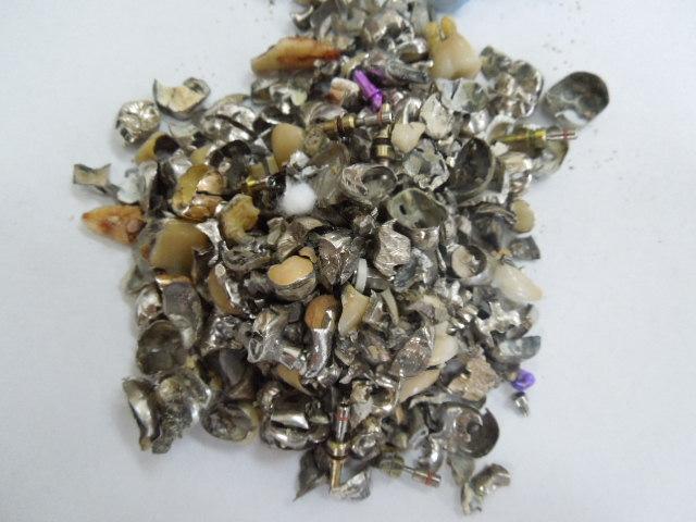 歯科金属屑・歯科スクラップ金属(撤去冠・除去冠)