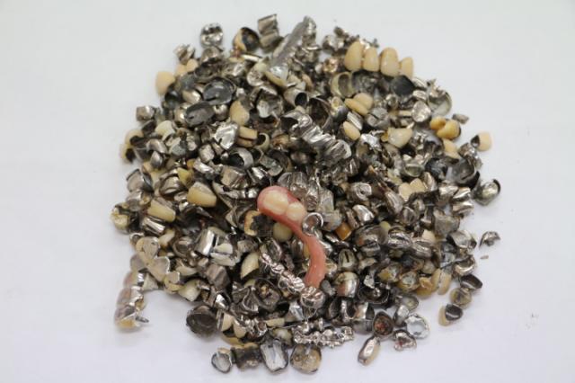 歯科金属屑・歯科スクラップ金属(撤去冠・除去冠)