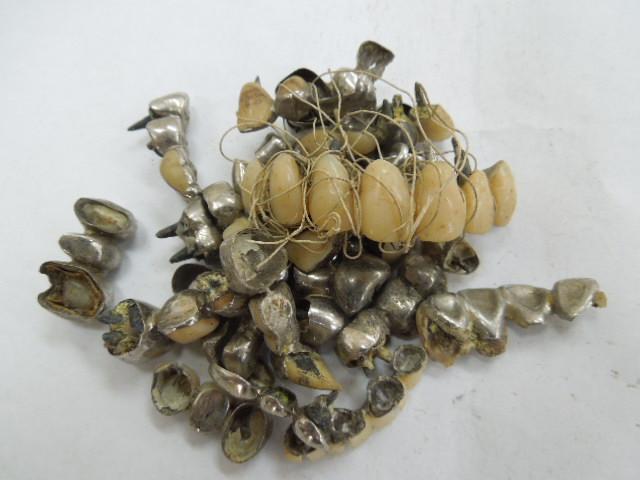 歯科金属屑・歯科スクラップ金属(撤去冠・除去冠)