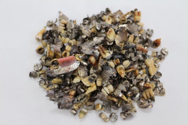 歯科金属屑・歯科スクラップ金属(撤去冠・除去冠)