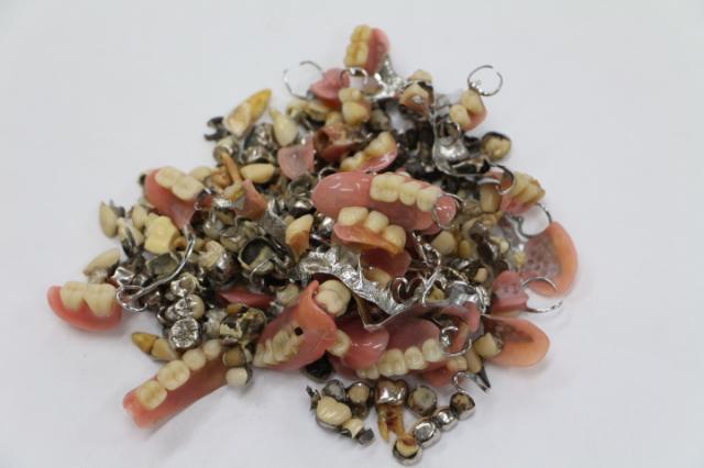 歯科金属屑・歯科スクラップ金属(撤去冠・除去冠)