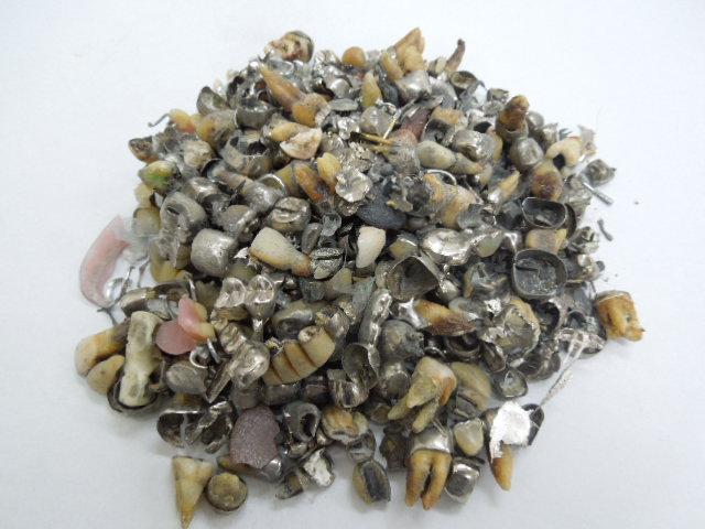 歯科金属屑・歯科スクラップ金属(撤去冠・除去冠)