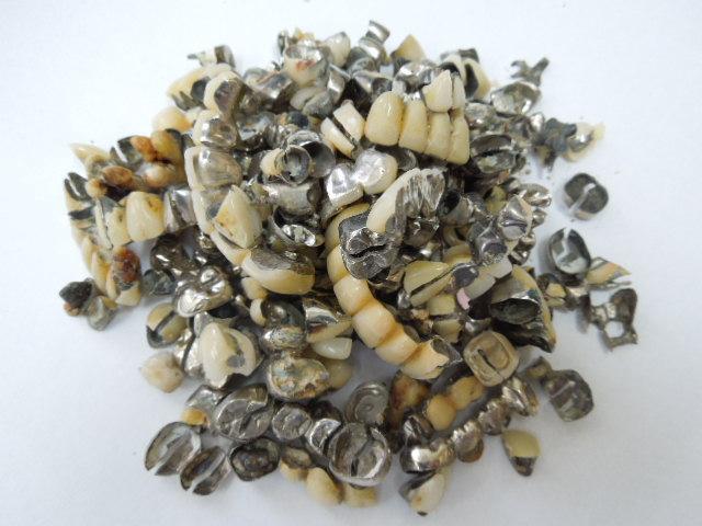 歯科金属屑・歯科スクラップ金属(撤去冠・除去冠)