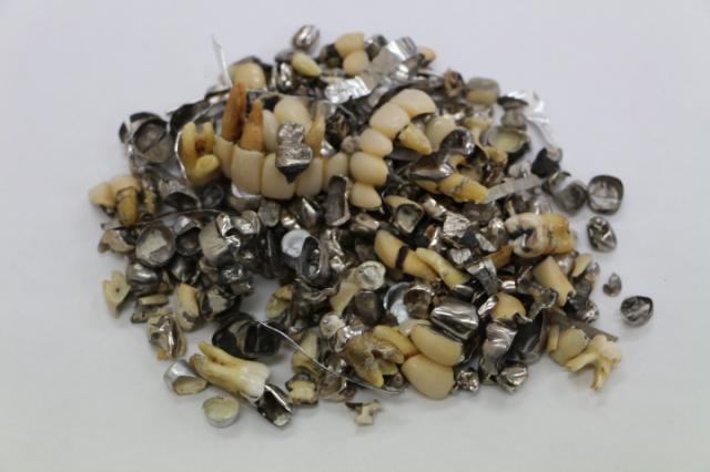 歯科金属屑・歯科スクラップ金属(撤去冠・除去冠)