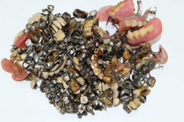 歯科金属屑・歯科スクラップ金属(撤去冠・除去冠)